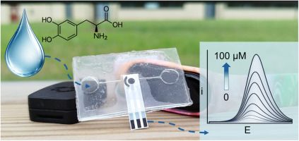 PDMS microfluidic layers and carbon screen-printed electrode before and after oxygen plasma treatment, showing the assembled sweat-sensing device with inlet, accumulating chamber, and outlet.